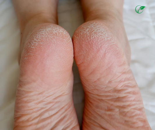 Sole Food: Why Regular Pedicures Are More Than Just Pretty Toes