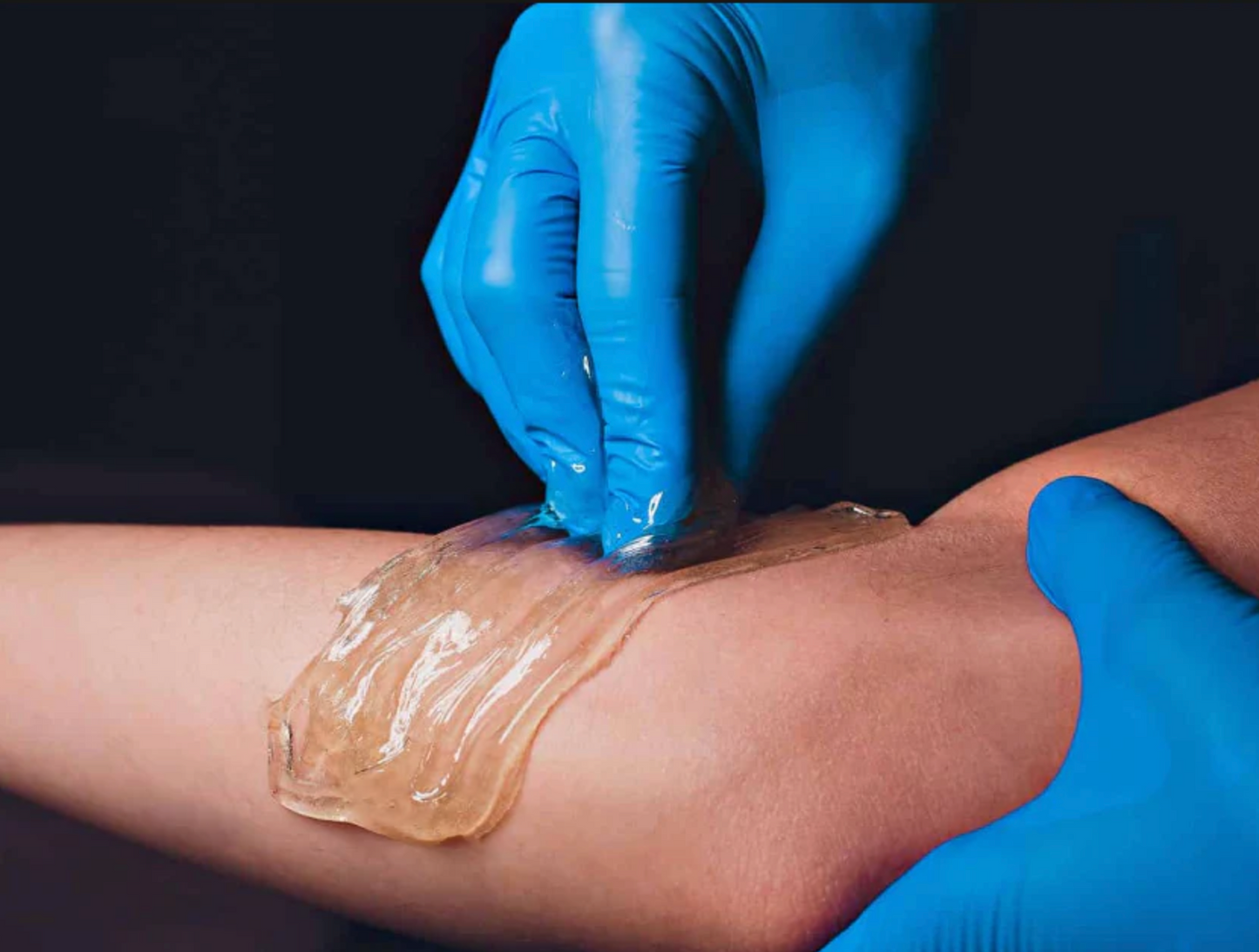 Half Arm Sugaring