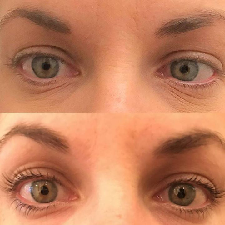 What's the deal with Lash Lifting?